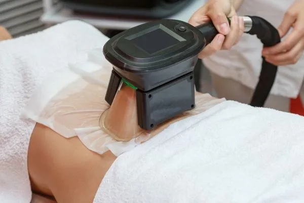 Image of person having fat freezing treatment to help weight gain Marlborough