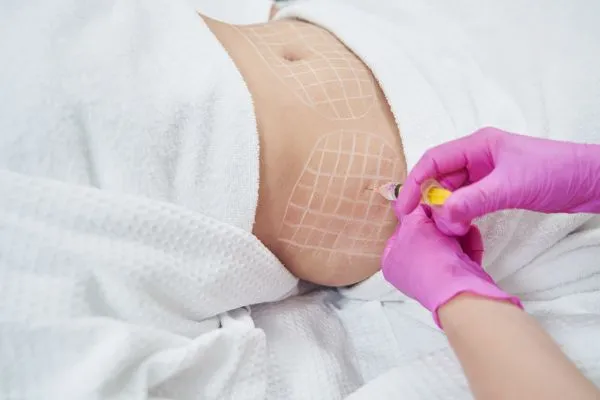 image of fat dissolving injections on love handles to help combat weight gain Marlborough