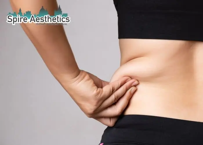 Image of woman pinching fat on their hips Marlborough. Fat Freezing treatment