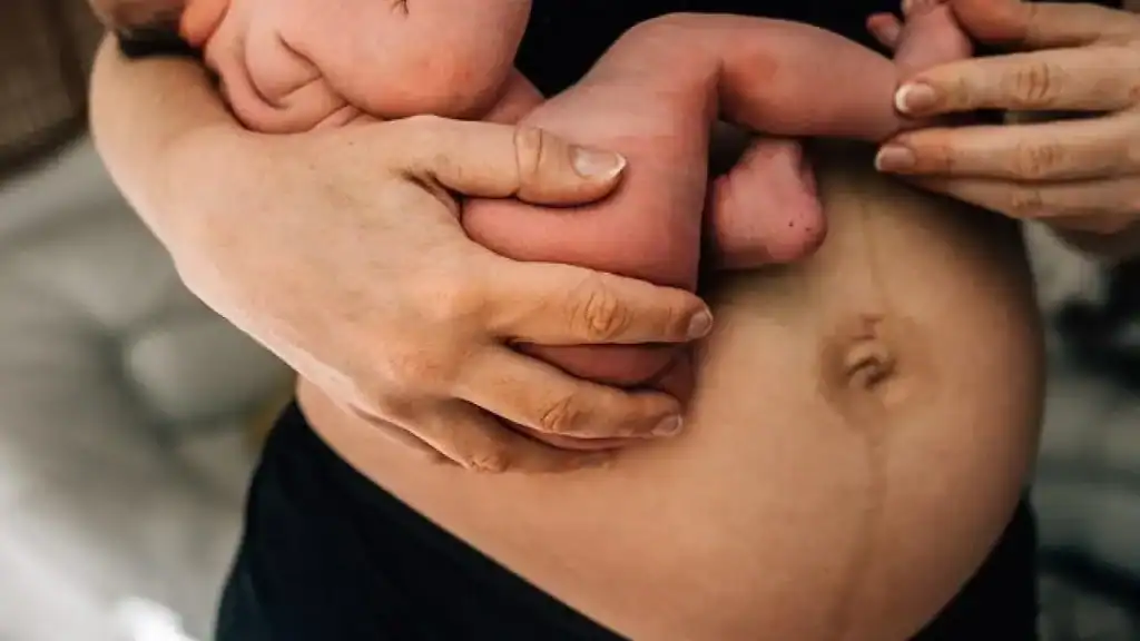 Why Is My Stomach Still Big After Pregnancy Marlborough?