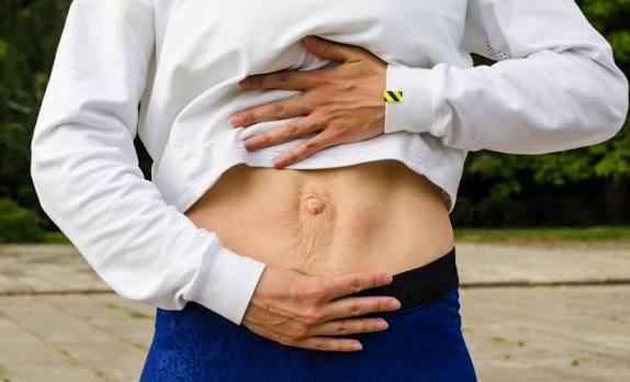 When Could Diastasis Recti Be the Missing Piece of the Puzzle Marlborough?